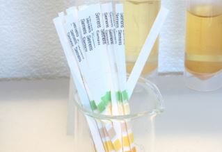 urine test