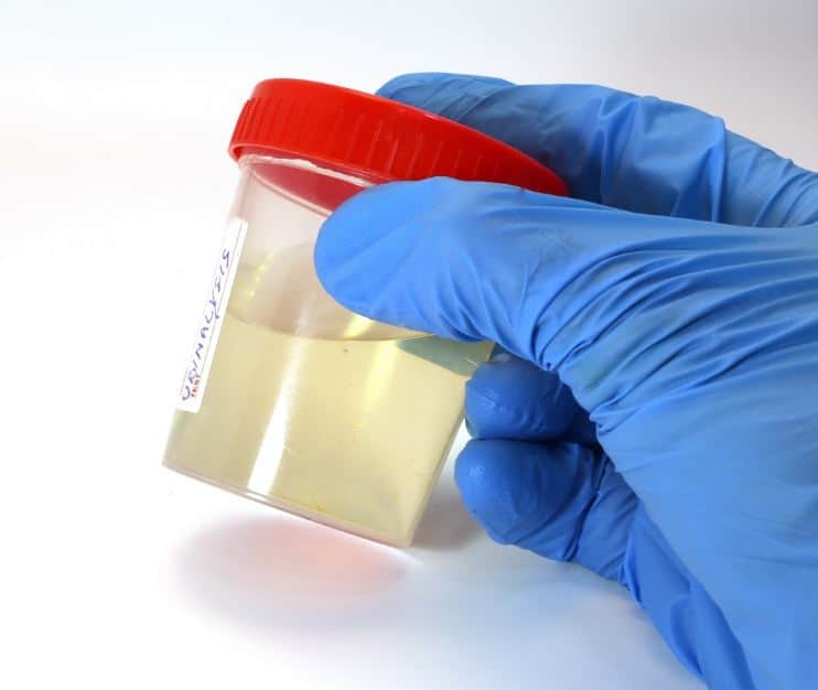 Does Mixing Urine and Water Work Against Drug Tests?
