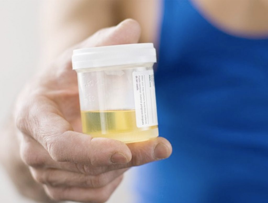 handling a pee sample