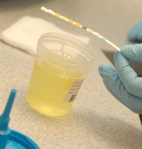 urine sample